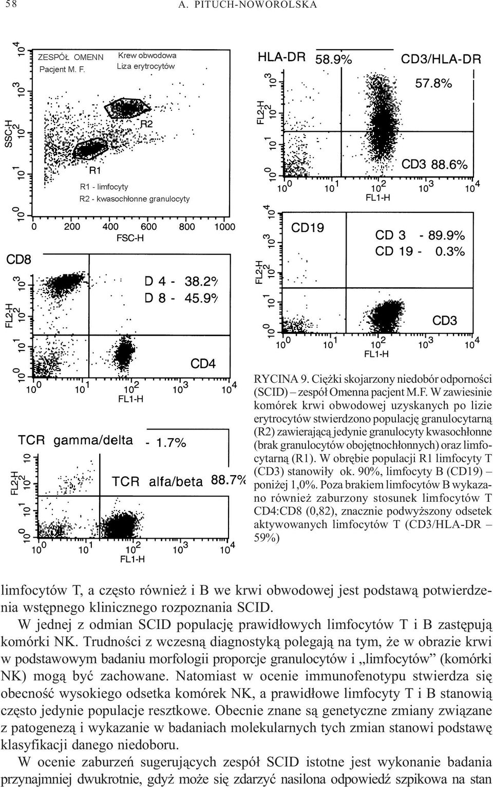 limfocytarn¹ (R1). W obrêbie populacji R1 limfocyty T () stanowi³y ok. 90%, limfocyty B (CD19) poni ej 1,0%.