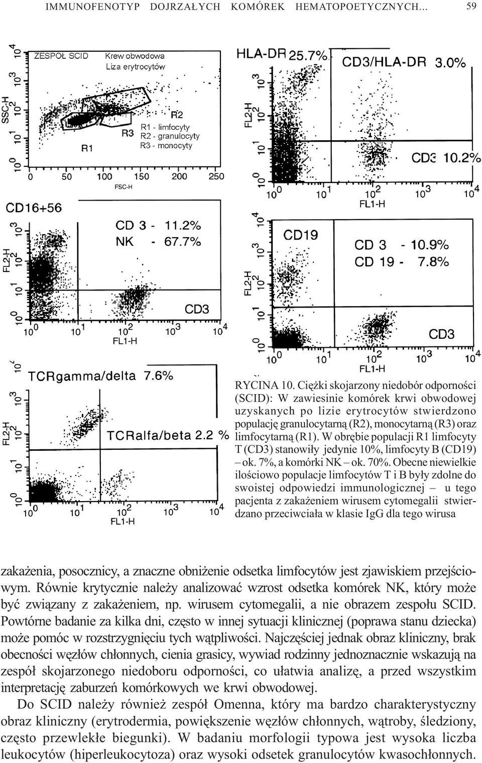 W obrêbie populacji R1 limfocyty T () stanowi³y jedynie 10%, limfocyty B (CD19) ok. 7%, a komórki NK ok. 70%.