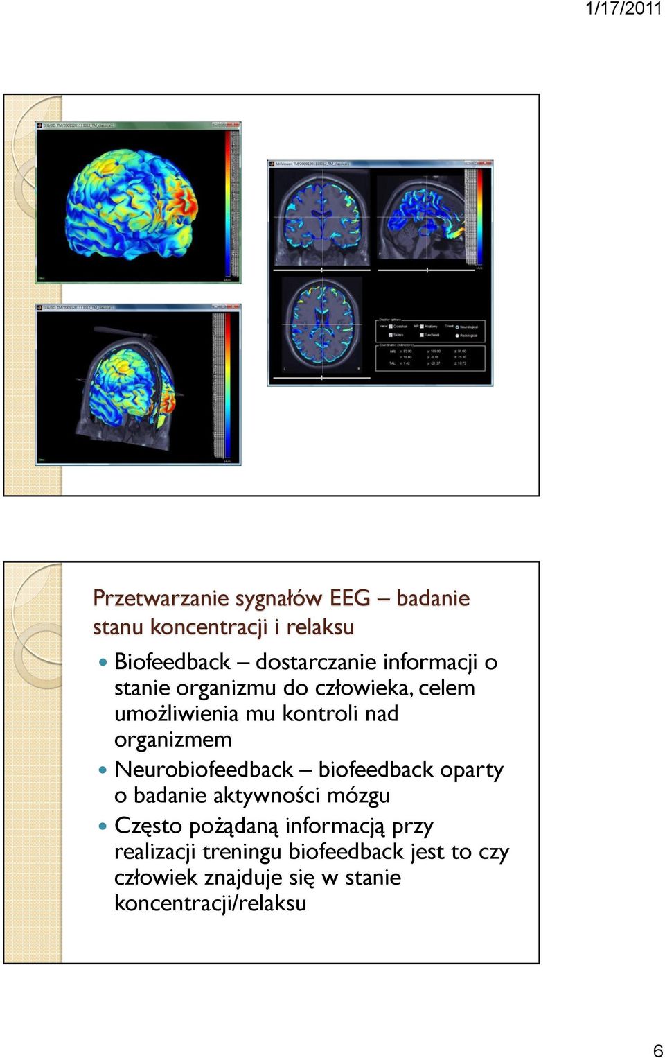 Neurobiofeedback biofeedback oparty o badanie aktywności mózgu Często pożądaną informacją