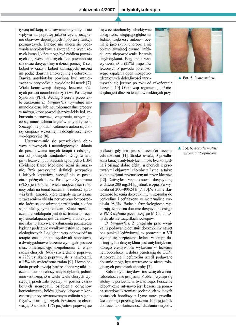 Dawka antybiotyku powinna być zmniejszona w przypadku niewydolności nerek [7]. Wiele kontrowersji dotyczy leczenia późnych postaci neuroboreliozy i tzw. Post Lyme Syndrom (PLS).