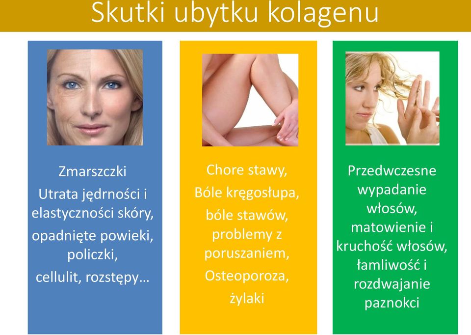 kręgosłupa, bóle stawów, problemy z poruszaniem, Osteoporoza, żylaki