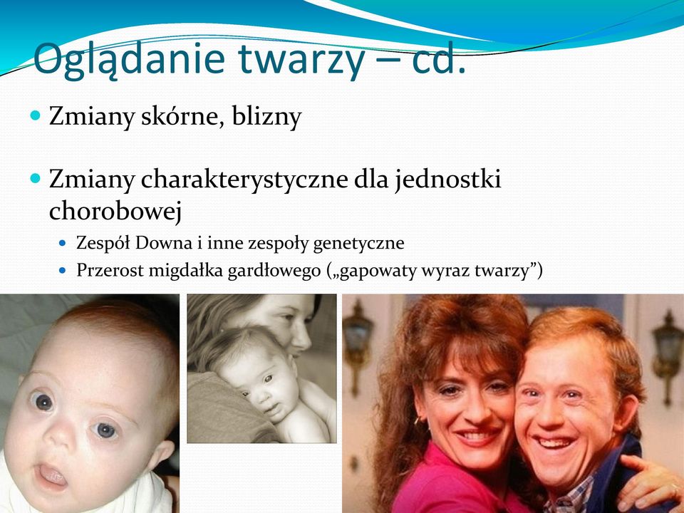 dla jednostki chorobowej Zespół Downa i inne