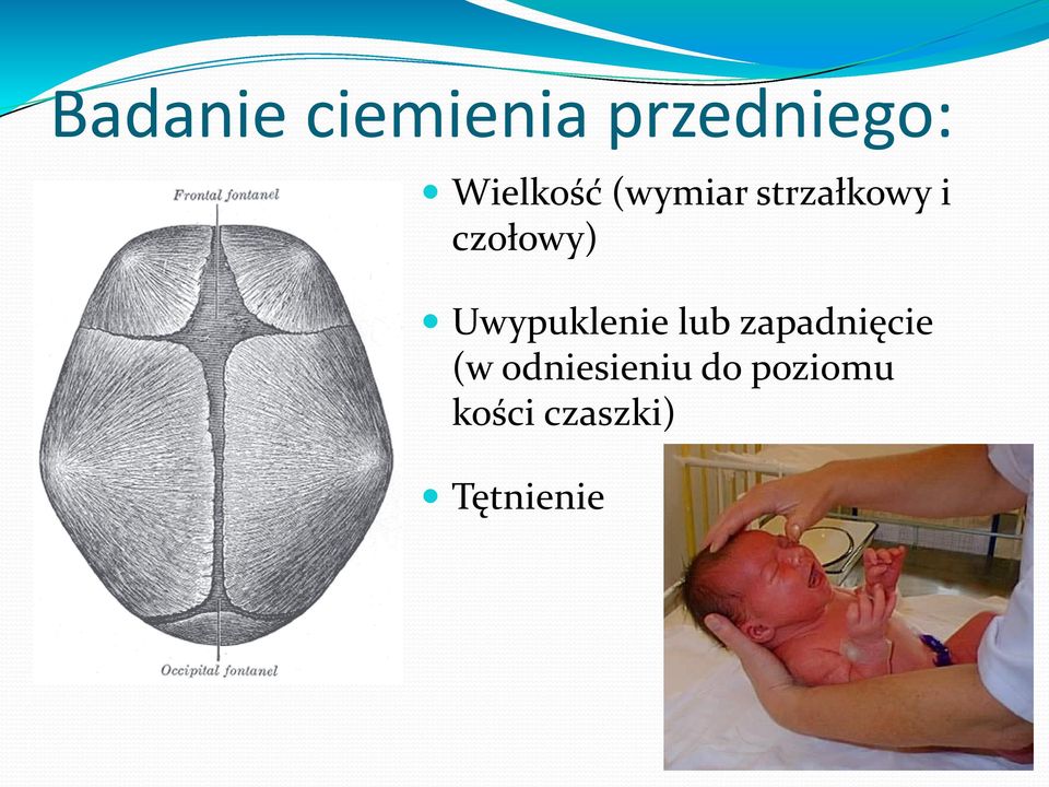 czołowy) Uwypuklenie lub zapadnięcie
