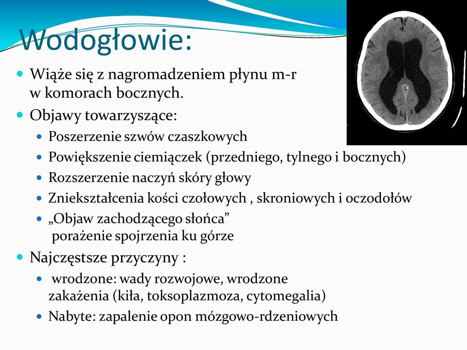 Rozszerzenie naczyń skóry głowy Zniekształcenia kości czołowych, skroniowych i oczodołów Objaw zachodzącego słońca