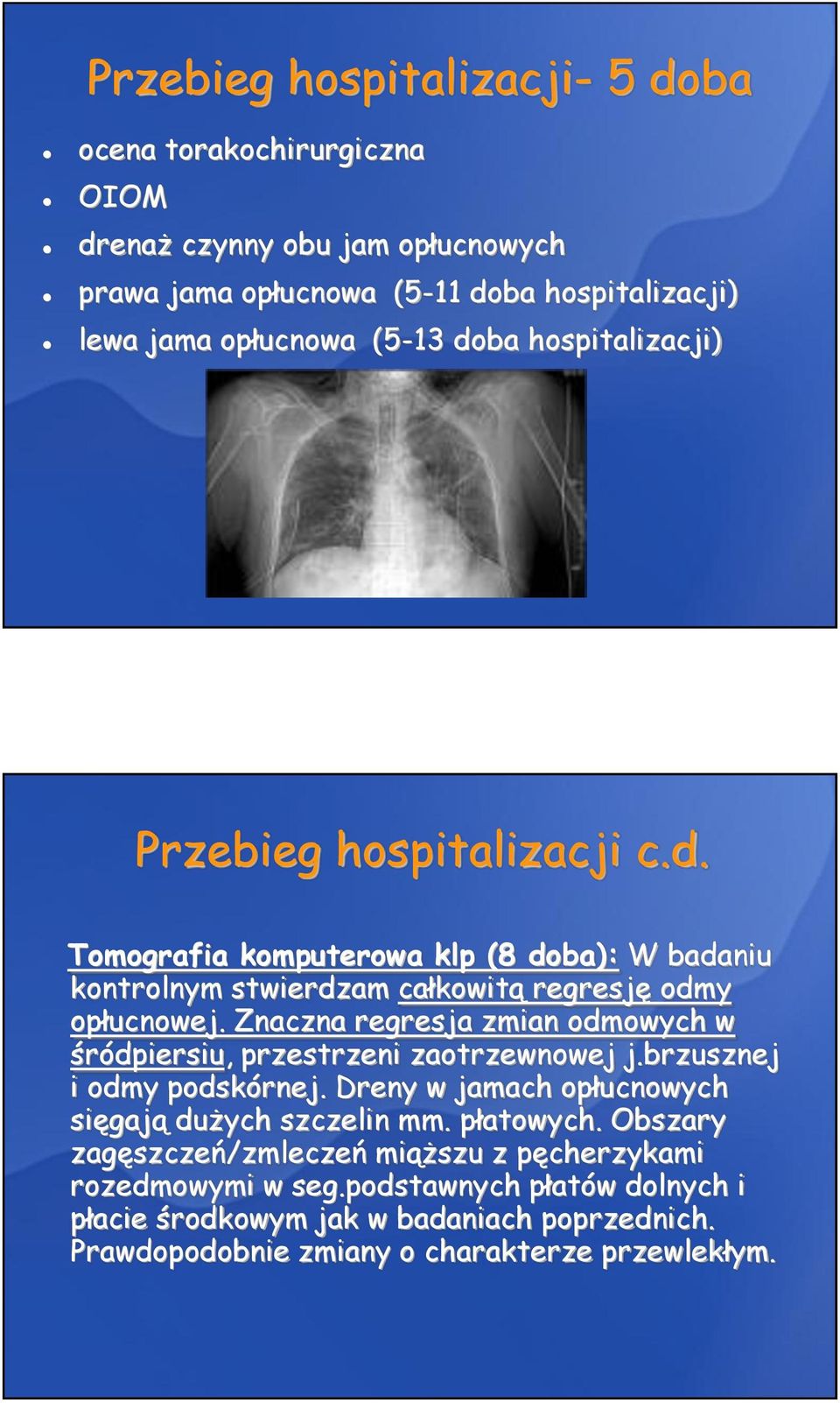 Znaczna regresja zmian odmowych w śródpiersiu, przestrzeni zaotrzewnowej j.brzusznej i odmy podskórnej. Dreny w jamach opłucnowych sięgają dużych szczelin mm. płatowych.
