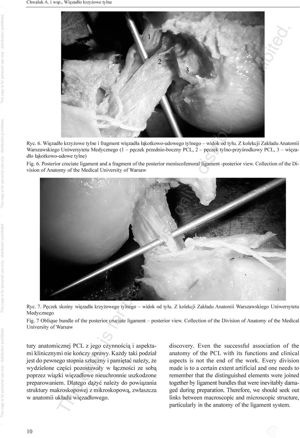 Posterior cruciate ligament and a fragment of the posterior meniscofemoral ligament -posterior view. Collection of the Division of Anatomy of the Medical University of Warsaw Ryc. 7.