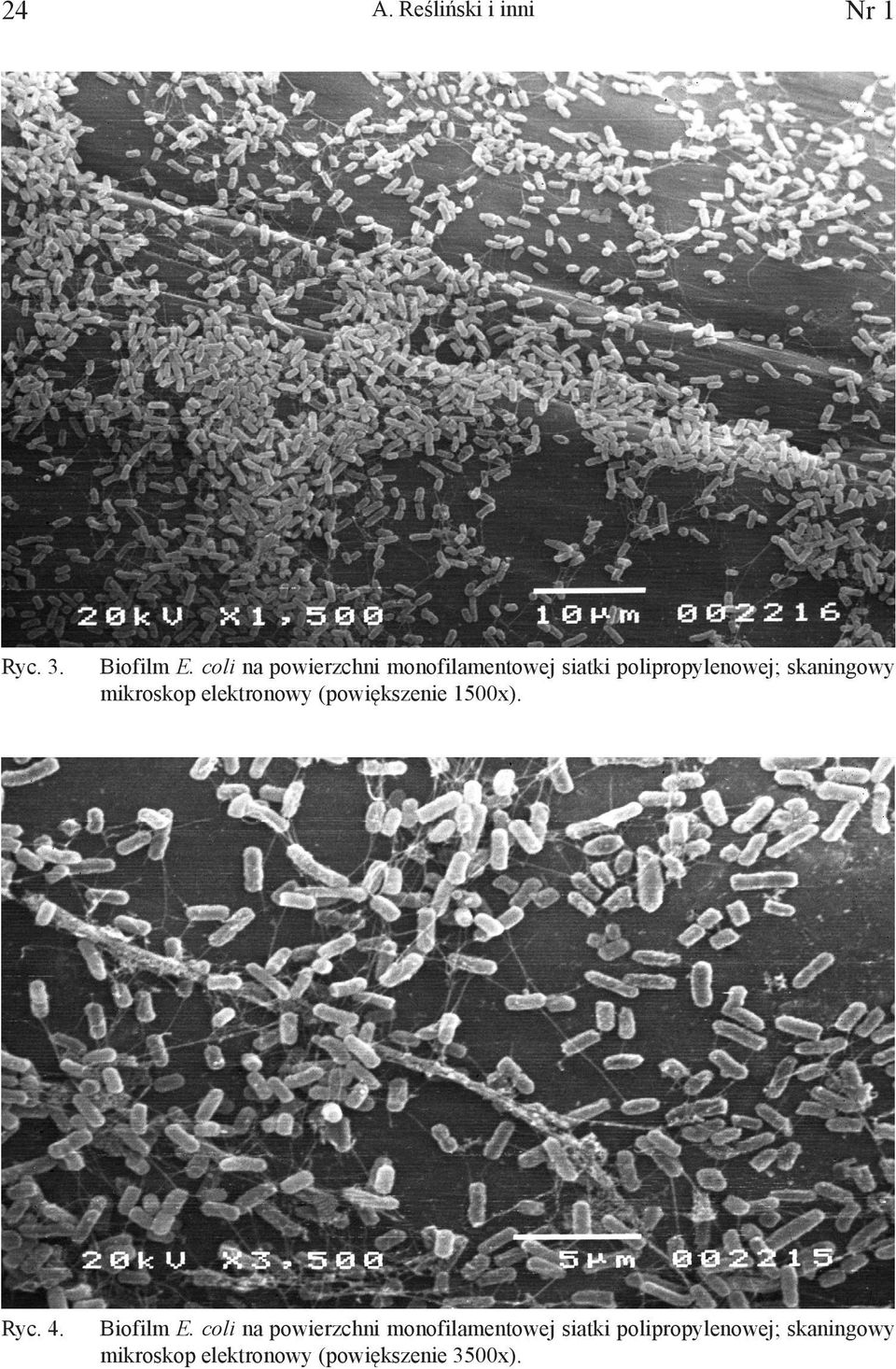 mikroskop elektronowy (powiększenie 1500x). Ryc. 4. Biofilm E.