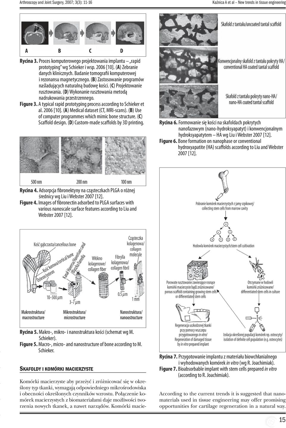 (D) Wykonanie rusztowania metodą nadrukowania przestrzennego. Figure 3. A typical rapid prototyping process according to Schieker et al. 2006 [10]. (A) Medical dataset (CT, MRI-scans).