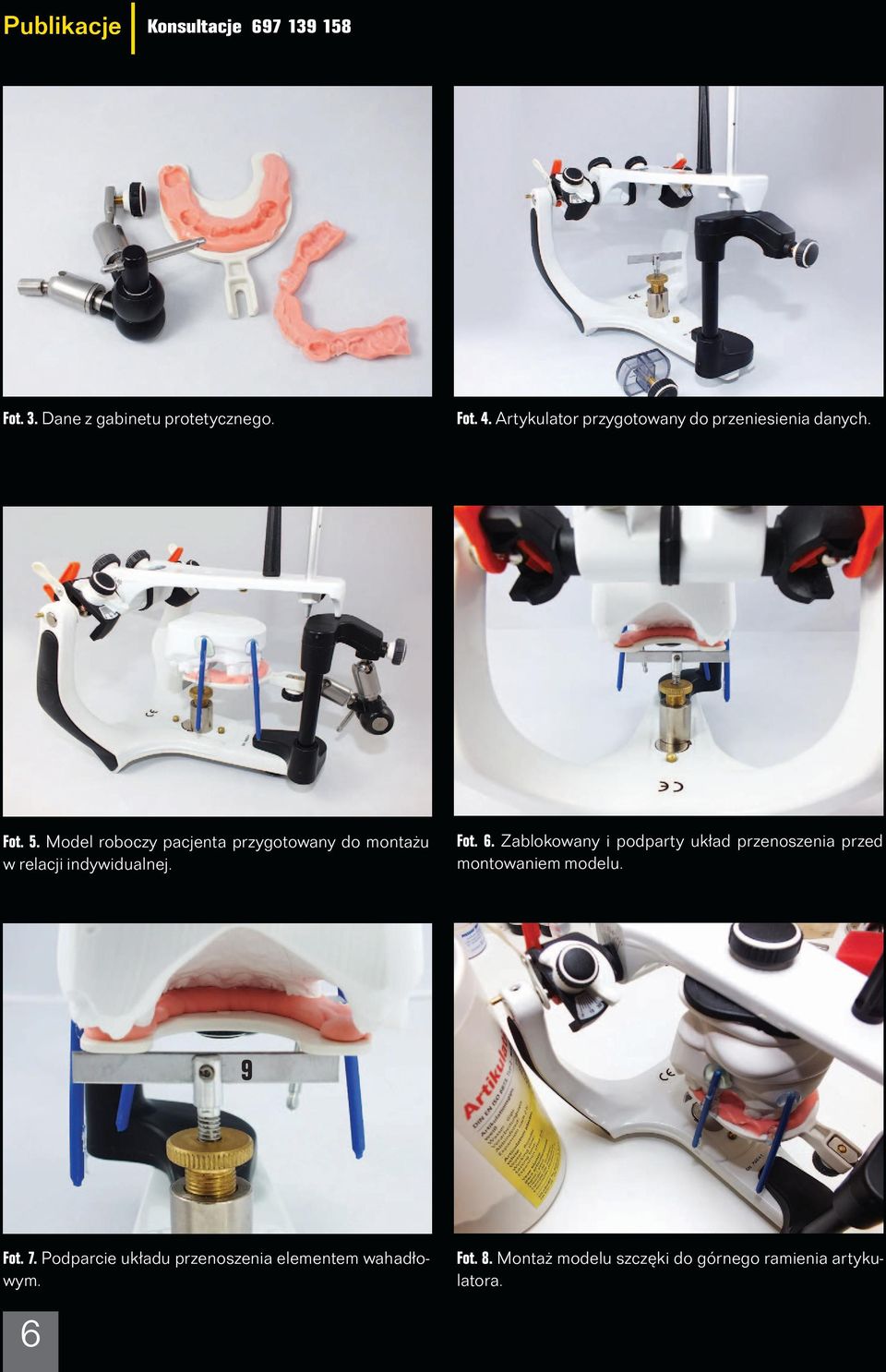 Model roboczy pacjenta przygotowany do montażu w relacji indywidualnej. Fot. 6.