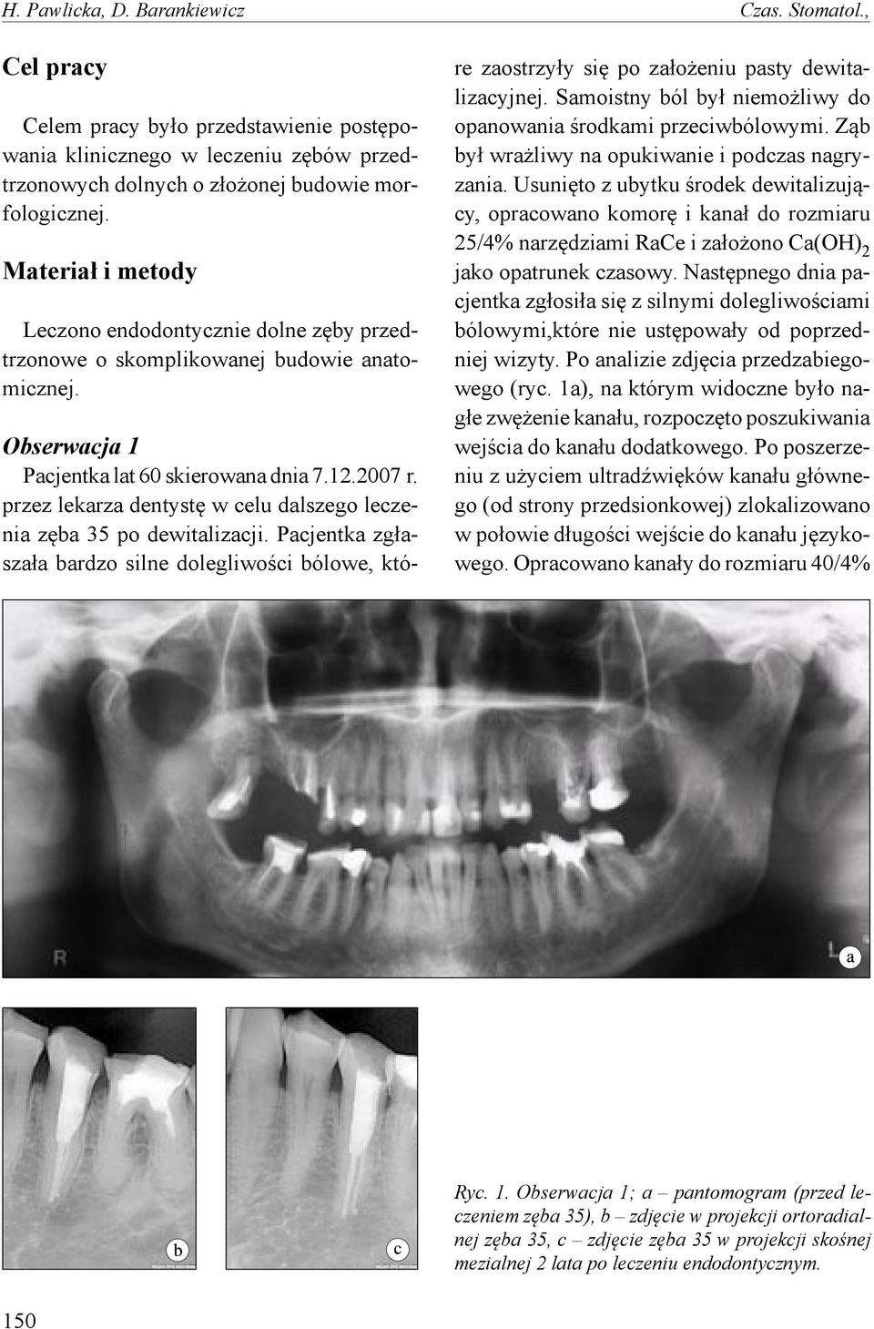 przez lekarza dentystę w celu dalszego leczenia zęba 35 po dewitalizacji. Pacjentka zgłaszała bardzo silne dolegliwości bólowe, które zaostrzyły się po założeniu pasty dewitalizacyjnej.