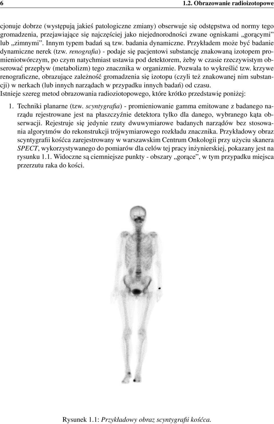 ogniskami gorącymi lub zimnymi. Innym typem badań są tzw. badania dynamiczne. Przykładem może być badanie dynamiczne nerek (tzw.