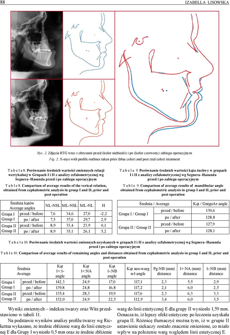 Comparison of average results of the verical relation, obtained from cephalometric analysis in group I and II, prior and post operation Średnia kątów Average s Grupa I Group I Grupa II Group II