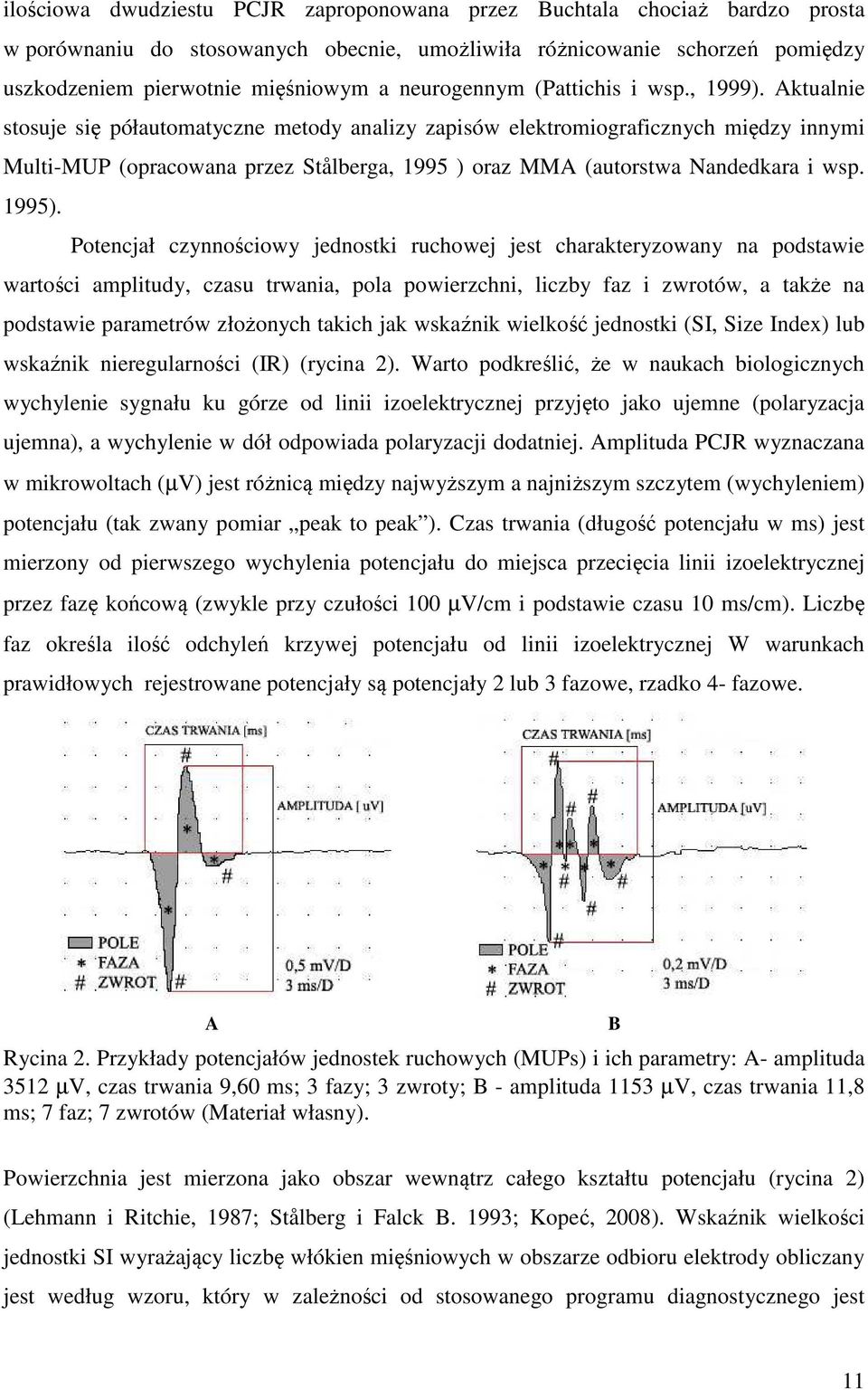 Aktualnie stosuje się półautomatyczne metody analizy zapisów elektromiograficznych między innymi Multi-MUP (opracowana przez Stålberga, 1995 ) oraz MMA (autorstwa Nandedkara i wsp. 1995).