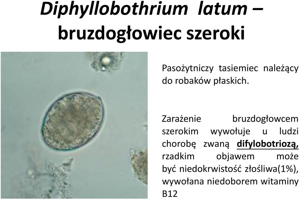 Zarażenie bruzdogłowcem szerokim wywołuje u ludzi chorobę zwaną