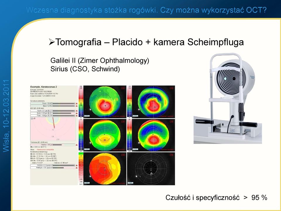 Ophthalmology) Sirius (CSO,