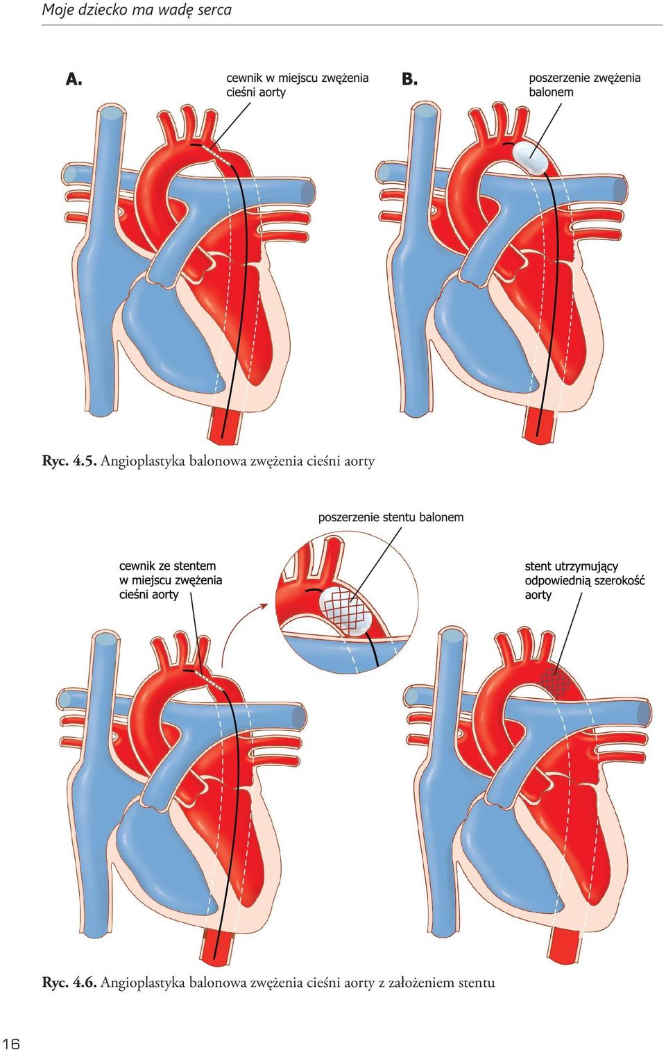 aorty Ryc. 4.6.