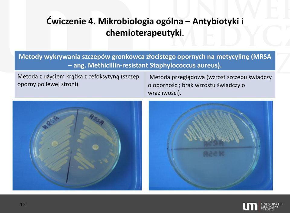 Methicillin-resistant Staphylococcus aureus).
