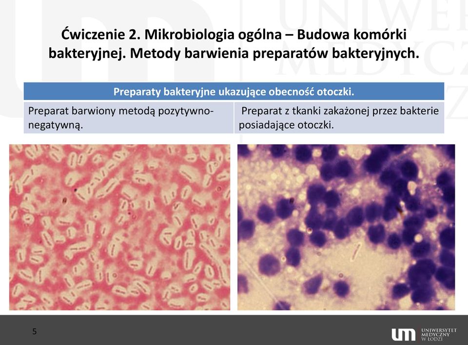 Preparaty bakteryjne ukazujące obecnośd otoczki.