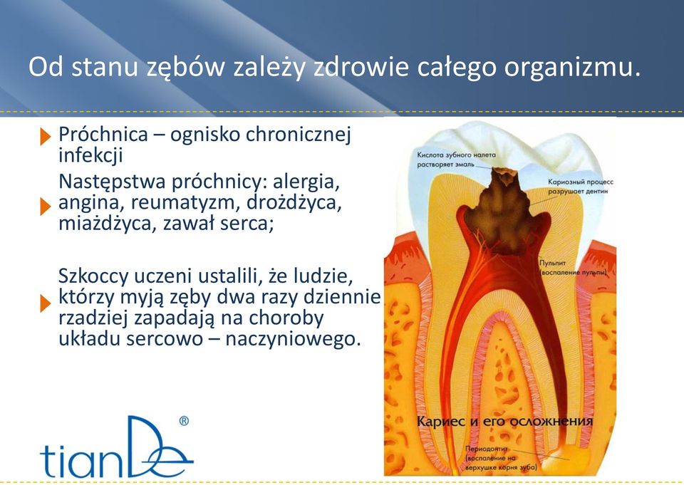 angina, reumatyzm, drożdżyca, miażdżyca, zawał serca; Szkoccy uczeni