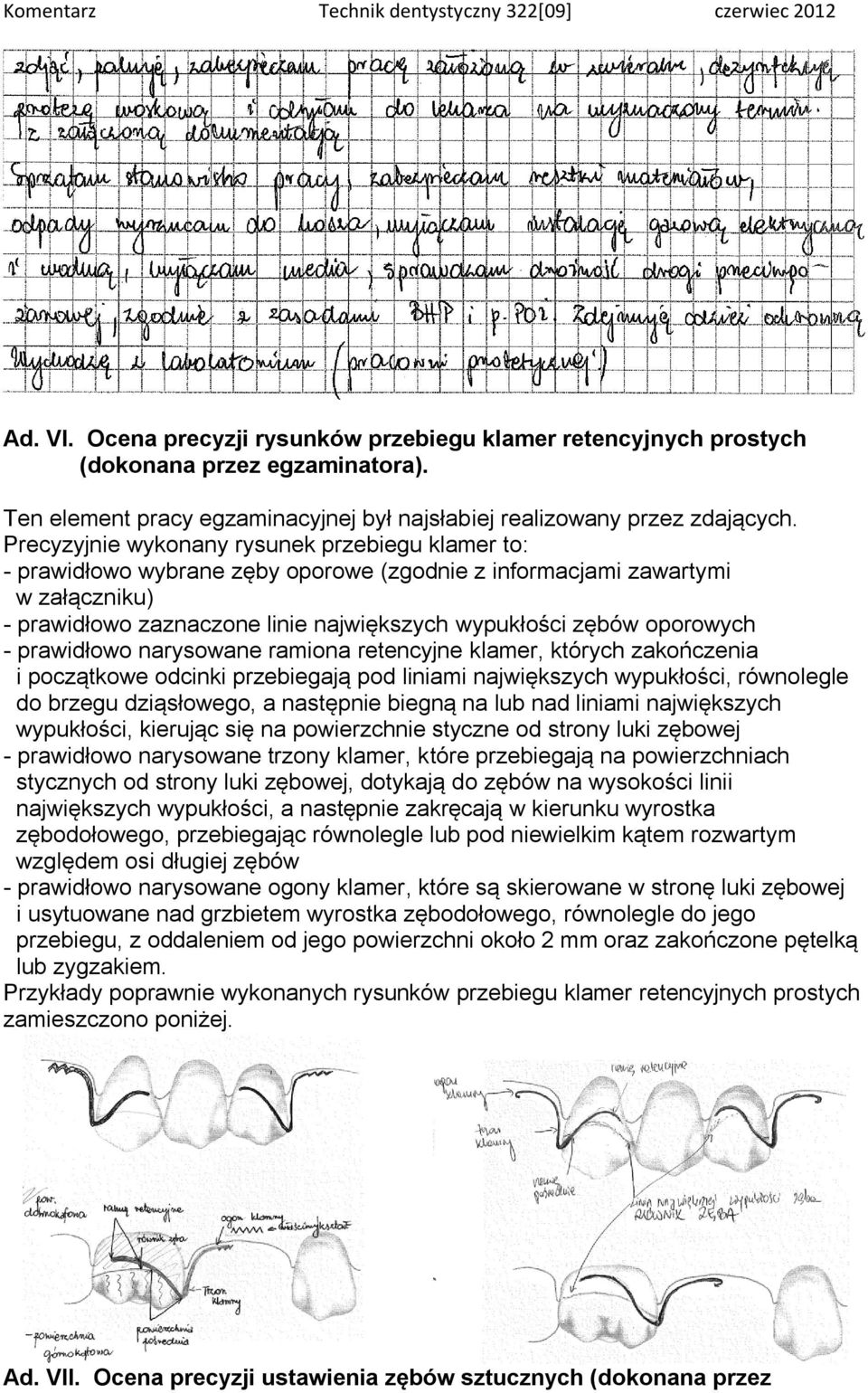 oporowych - prawidłowo narysowane ramiona retencyjne klamer, których zakończenia i początkowe odcinki przebiegają pod liniami największych wypukłości, równolegle do brzegu dziąsłowego, a następnie