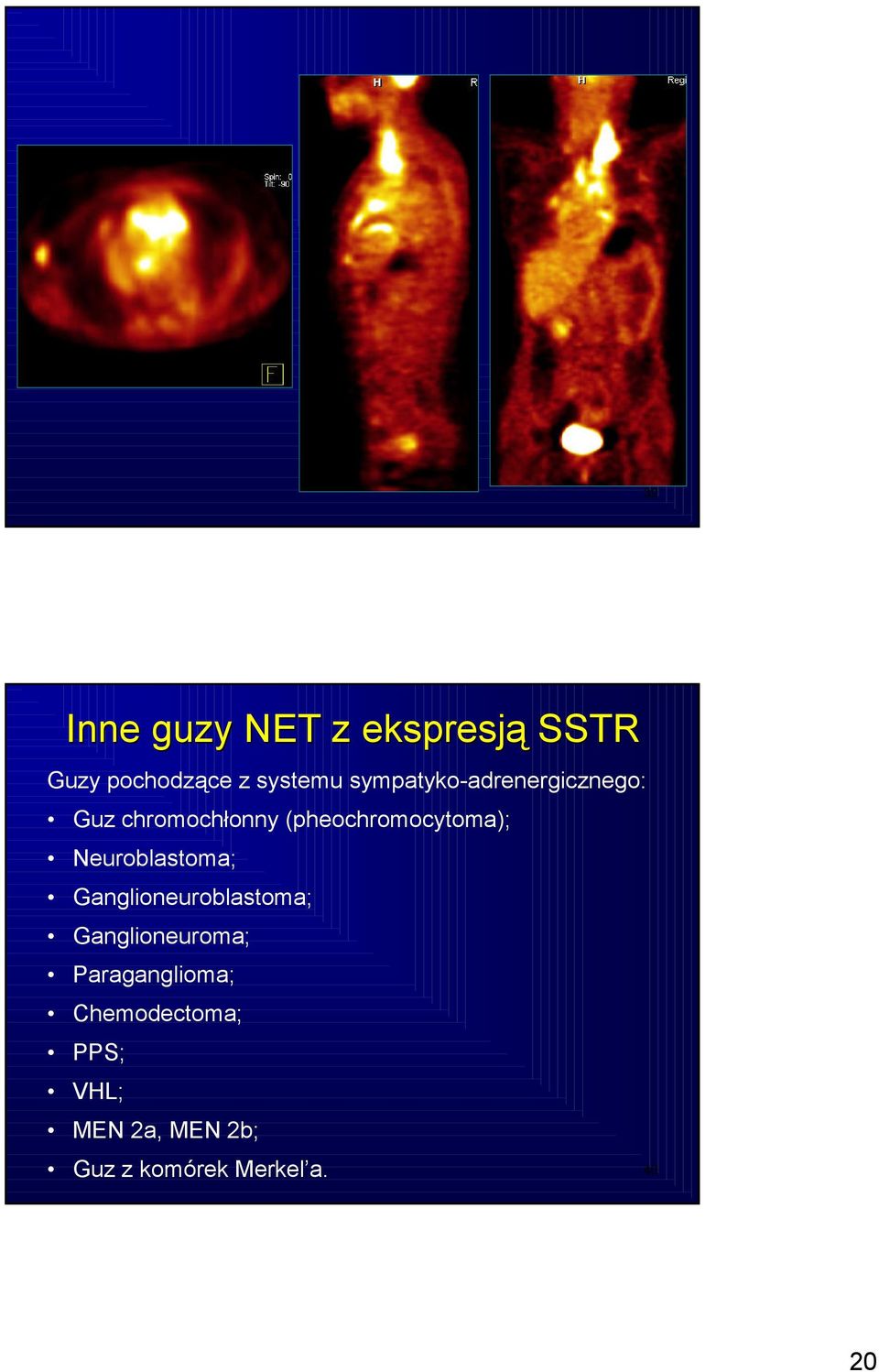 Neuroblastoma; Ganglioneuroblastoma; Ganglioneuroma;