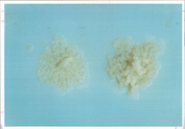 Hodowla Mycobacterium