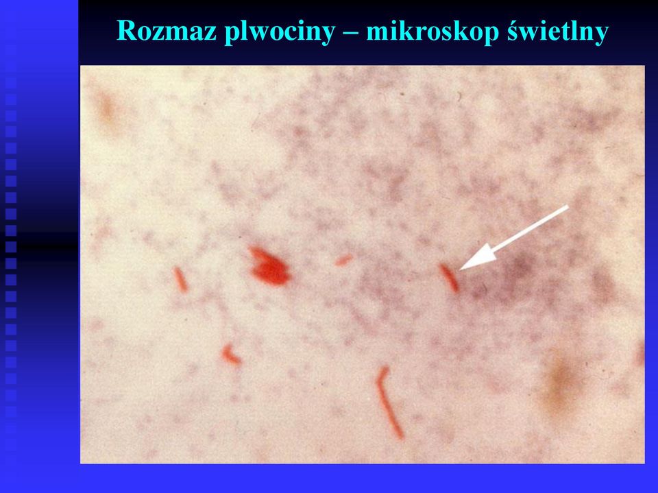 mikroskop