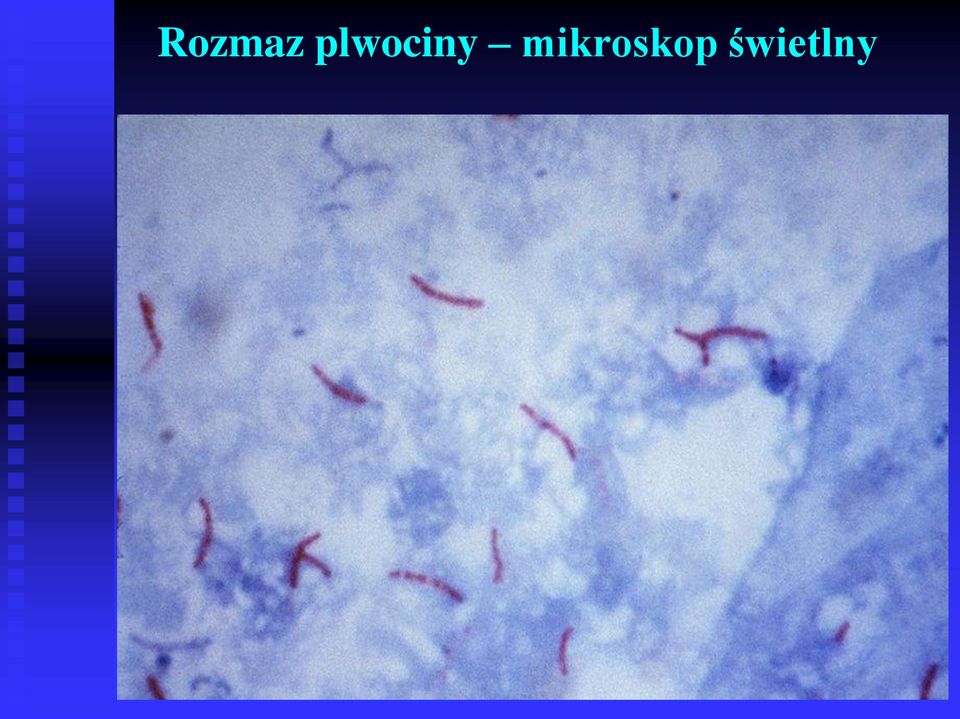mikroskop