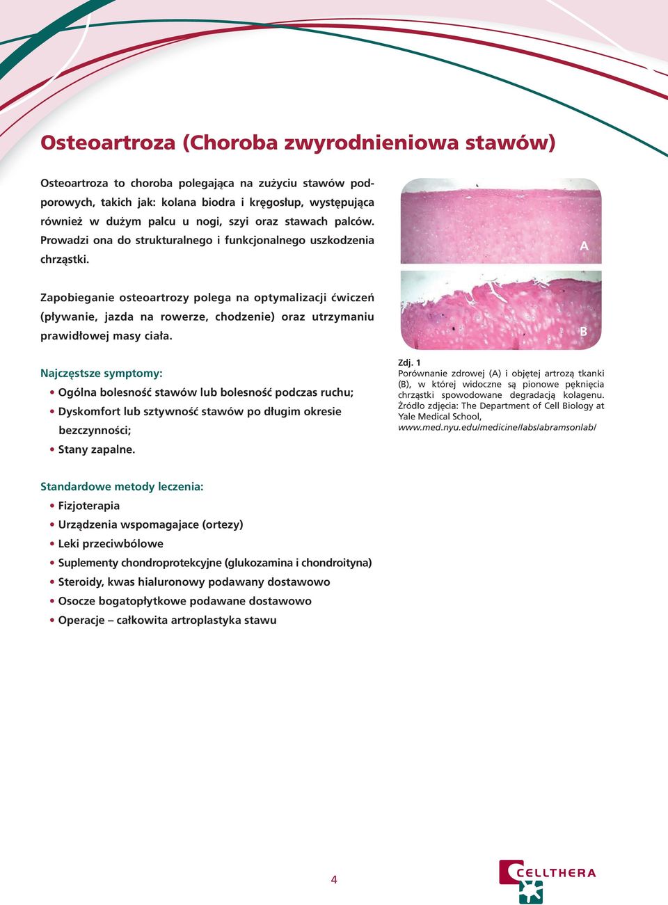 A Zapobieganie osteoartrozy polega na optymalizacji ćwiczeń (pływanie, jazda na rowerze, chodzenie) oraz utrzymaniu prawidłowej masy ciała.