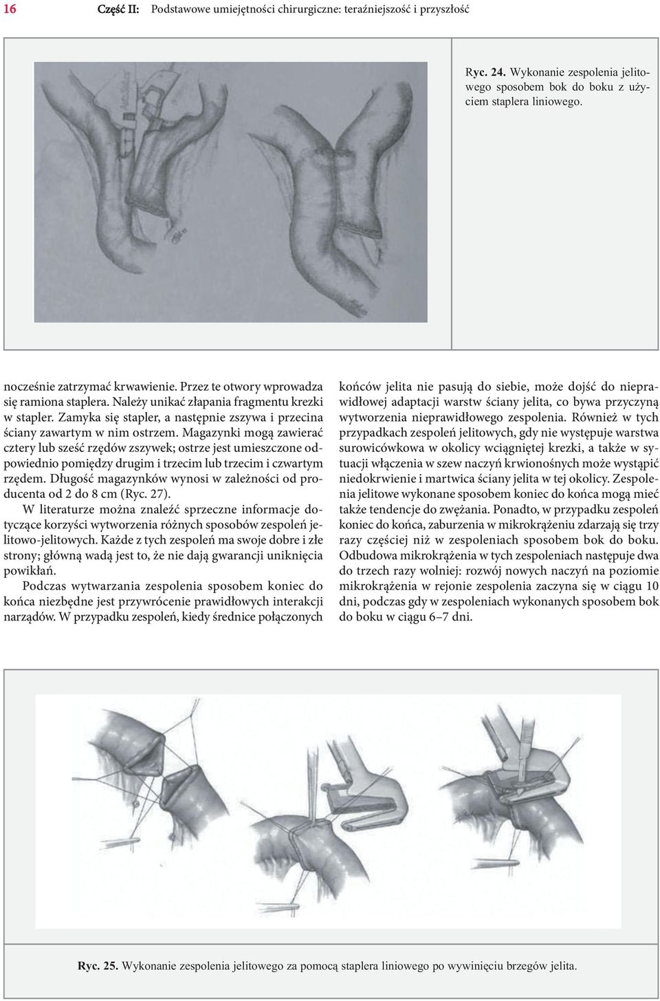 Techniki staplerowe w operacjach przewodu pokarmowego ILIYA M. BURIEV,  MIKEL V. KNAZEV - PDF Free Download