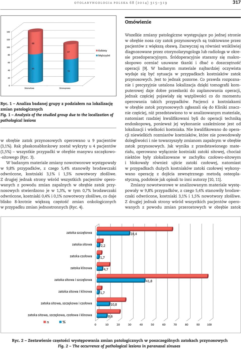 Rak płaskonabłonkowy został wykryty u 4 pacjentów (1,5%) wszystkie przypadki w obrębie masywu szczękowo- -sitowego (Ryc. 3).