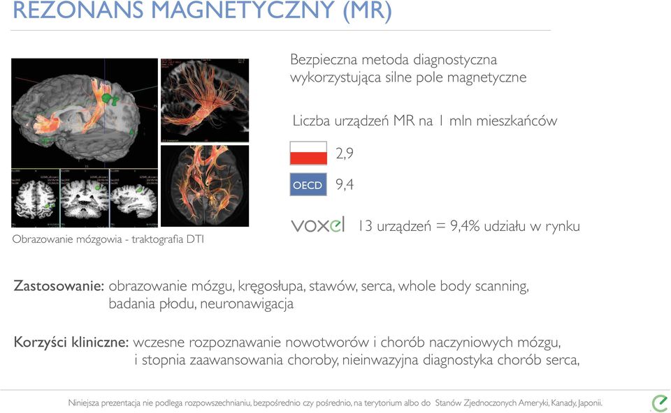 obrazowanie mózgu, kręgosłupa, stawów, serca, whole body scanning, badania płodu, neuronawigacja Korzyści kliniczne: