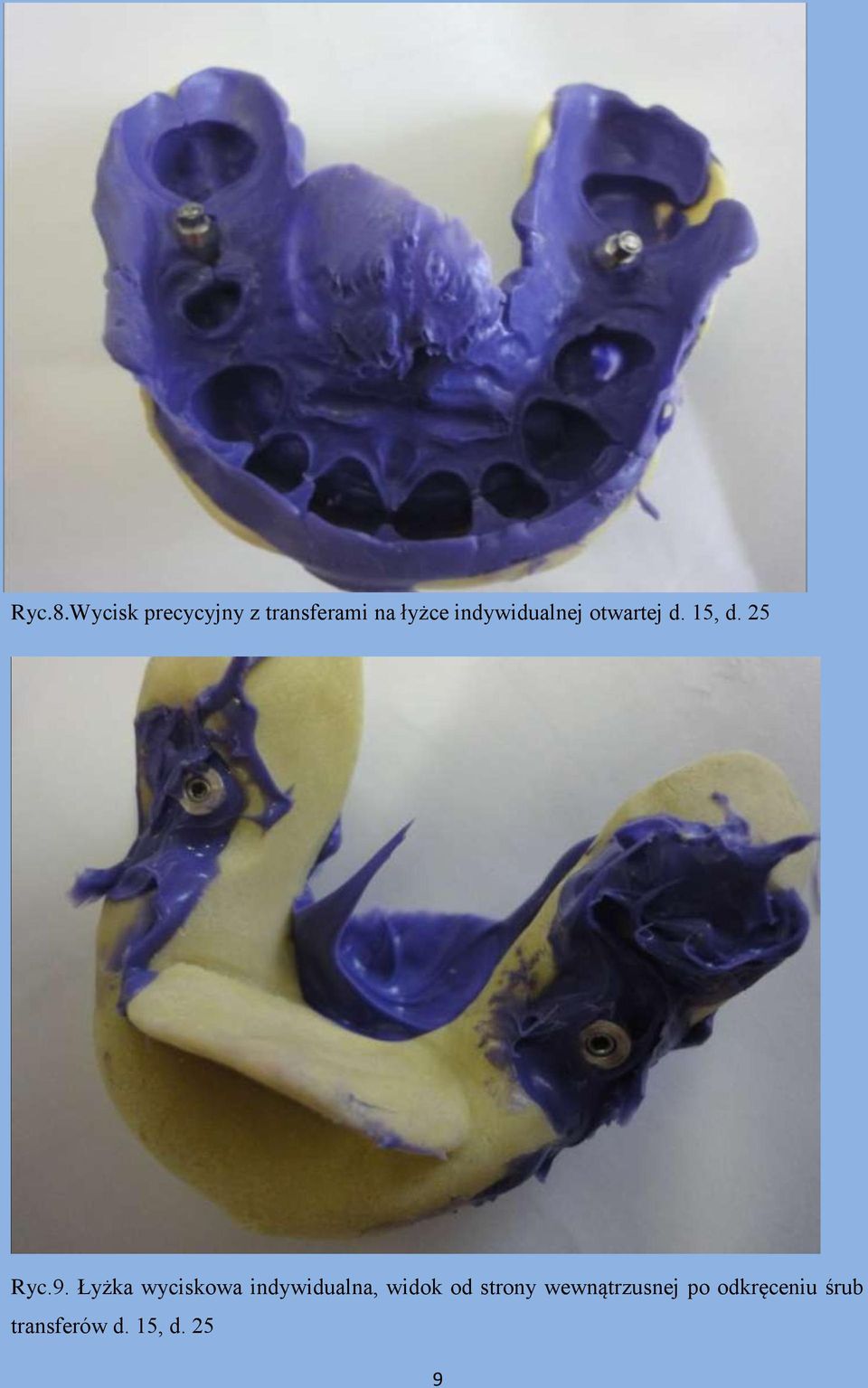 indywidualnej otwartej d. 15, d. 25 Ryc.9.