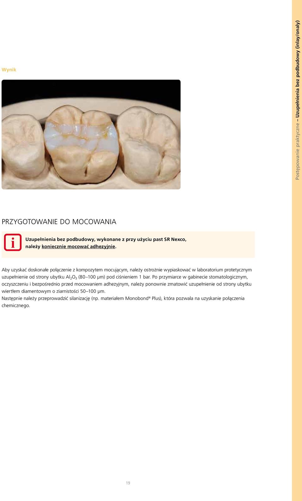 Aby uzyskaç doskona e po àczenie z kompozytem mocujàcym, nale y ostro nie wypiaskowaç w laboratorium protetycznym uzupe nienie od strony ubytku Al 2 O 3 (80 100 µm) pod ciênieniem