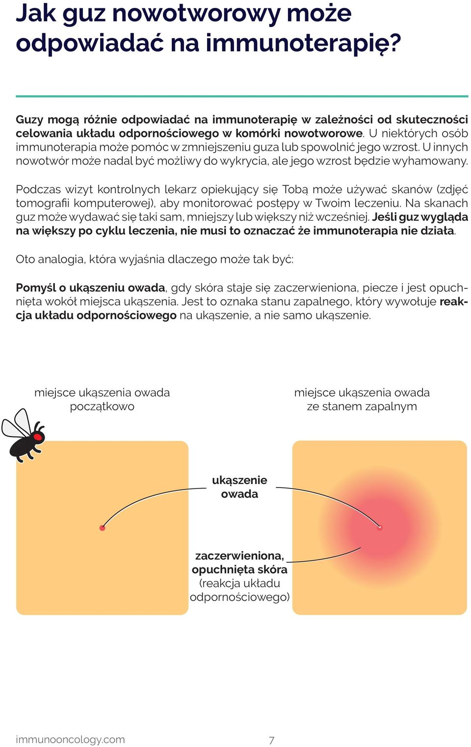 Podczas wizyt kontrolnych lekarz opiekujący się Tobą może używać skanów (zdjęć tomografii komputerowej), aby monitorować postępy w Twoim leczeniu.