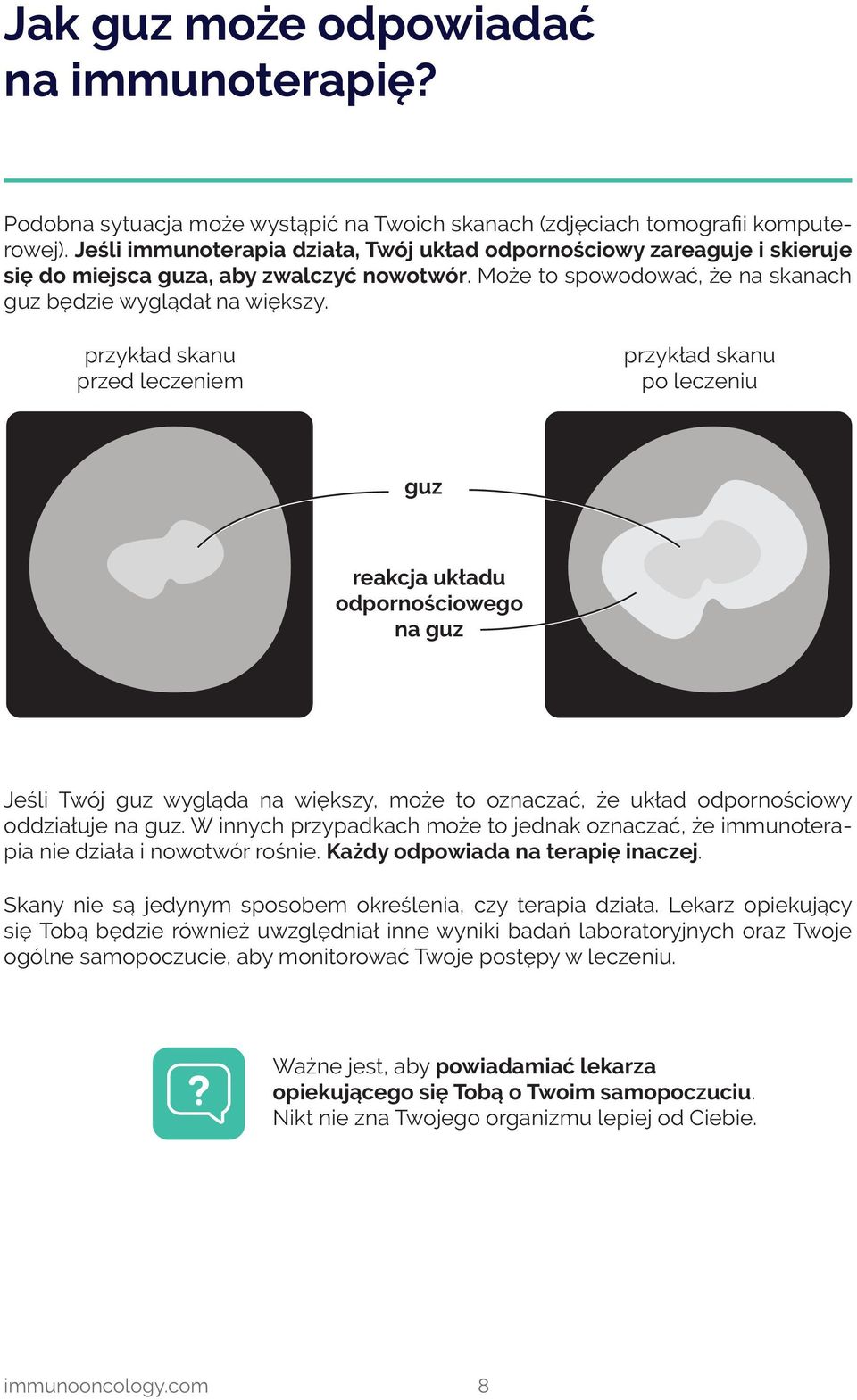 przykład skanu przed leczeniem przykład skanu po leczeniu guz reakcja układu odpornościowego na guz Jeśli Twój guz wygląda na większy, może to oznaczać, że układ odpornościowy oddziałuje na guz.