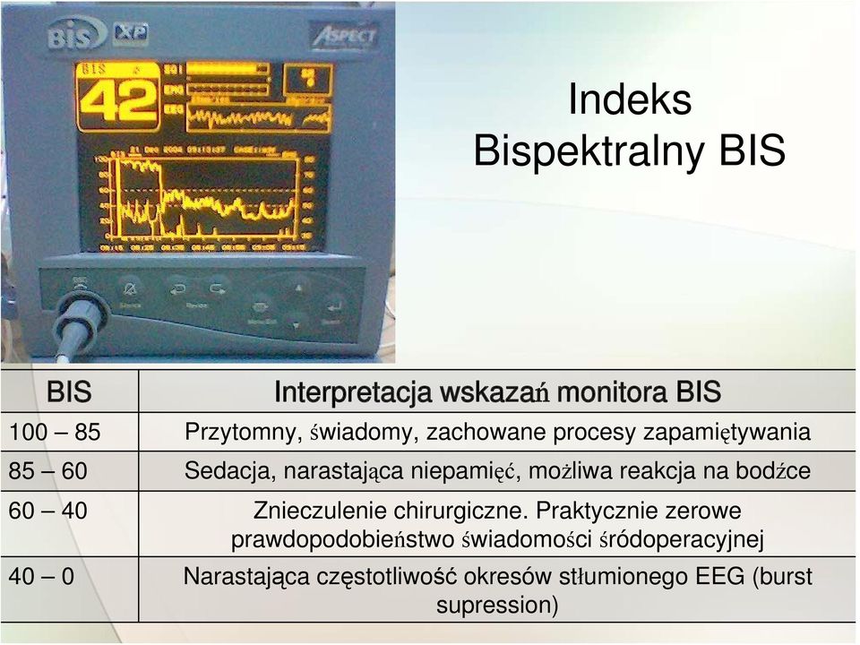 reakcja na bodźce 60 40 Znieczulenie chirurgiczne.