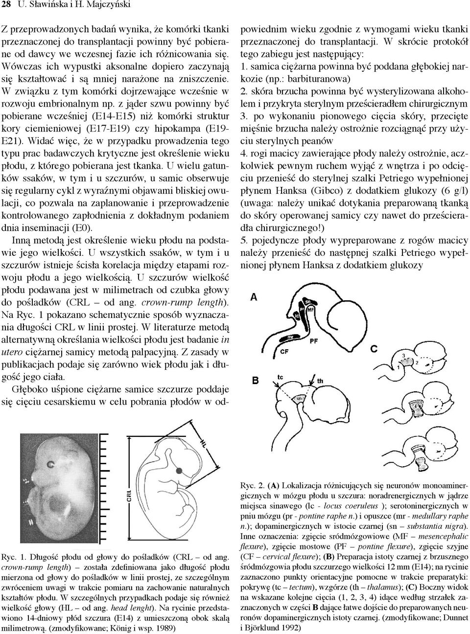 z jąder szwu powinny być pobierane wcześniej (E14-E15) niż komórki struktur kory ciemieniowej (E17-E19) czy hipokampa (E19- E21).