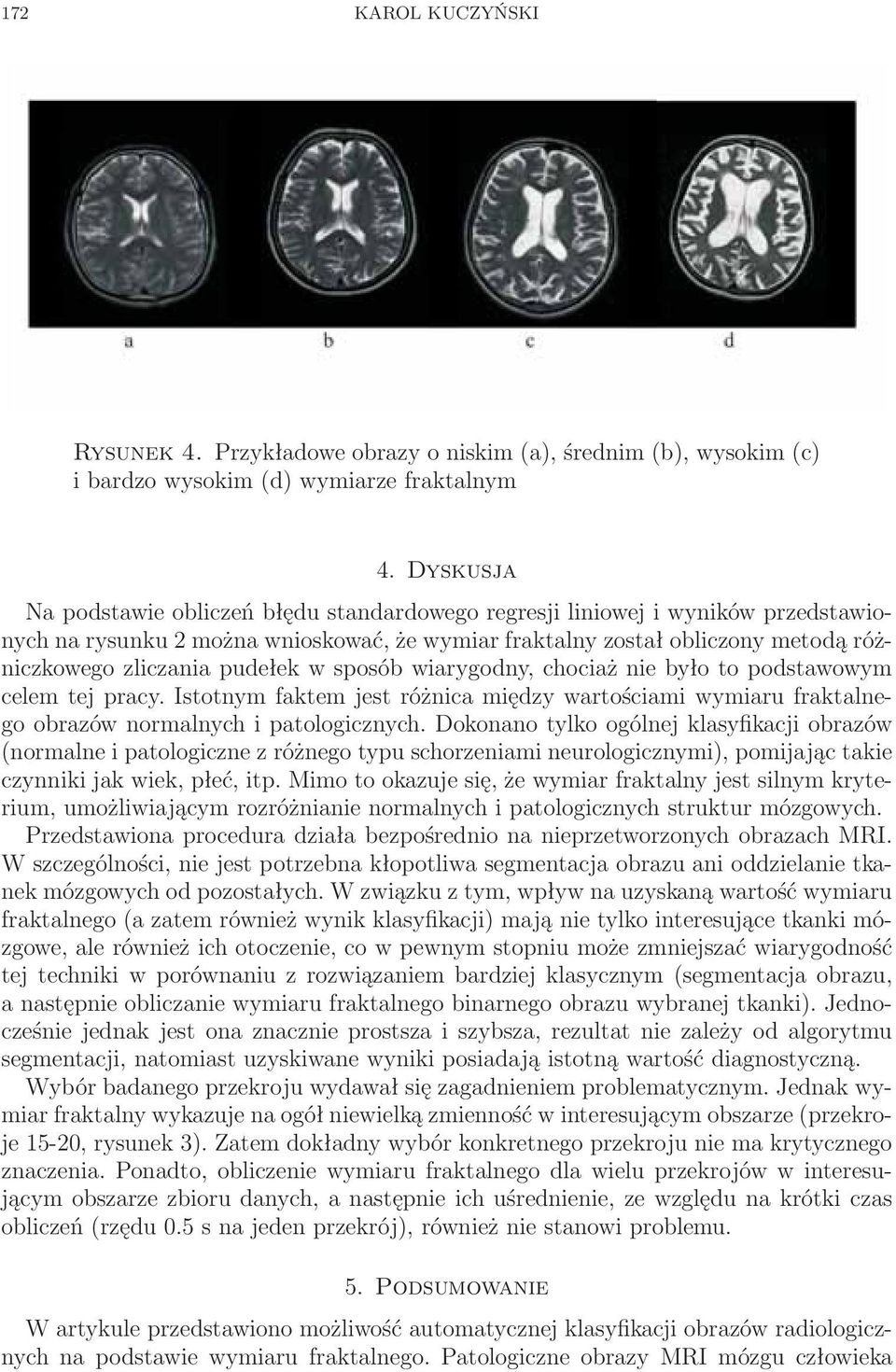 pudełek w sposób wiarygodny, chociaż nie było to podstawowym celem tej pracy. Istotnym faktem jest różnica między wartościami wymiaru fraktalnego obrazów normalnych i patologicznych.