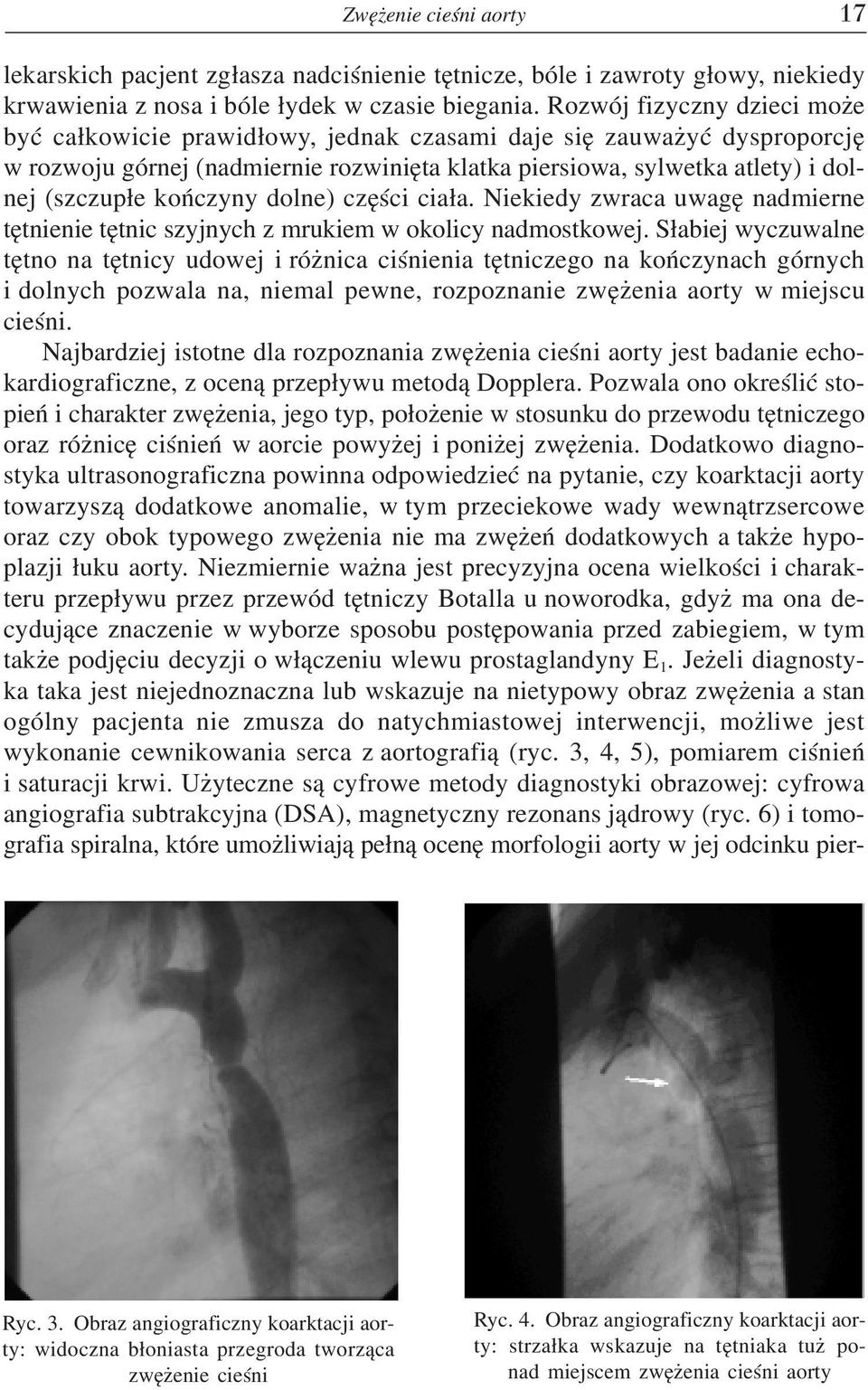 koñczyny dolne) czêœci cia³a. Niekiedy zwraca uwagê nadmierne têtnienie têtnic szyjnych z mrukiem w okolicy nadmostkowej.