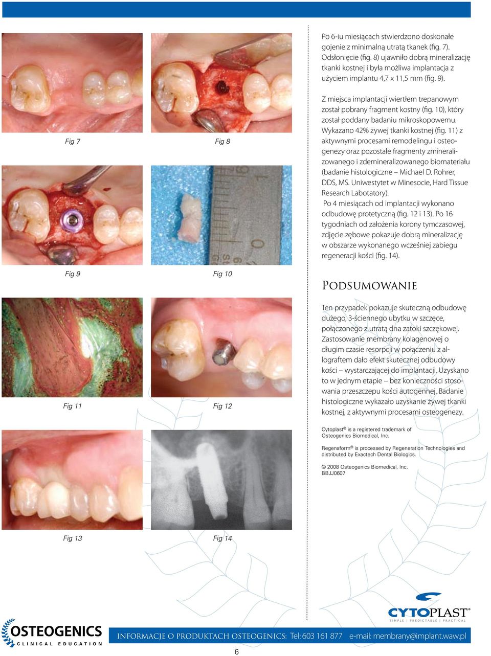 Fig 7 Fig 8 Fig 9 Fig 10 Fig 11 Fig 12 Z miejsca implantacji wiertłem trepanowym został pobrany fragment kostny (fig. 10), który został poddany badaniu mikroskopowemu.