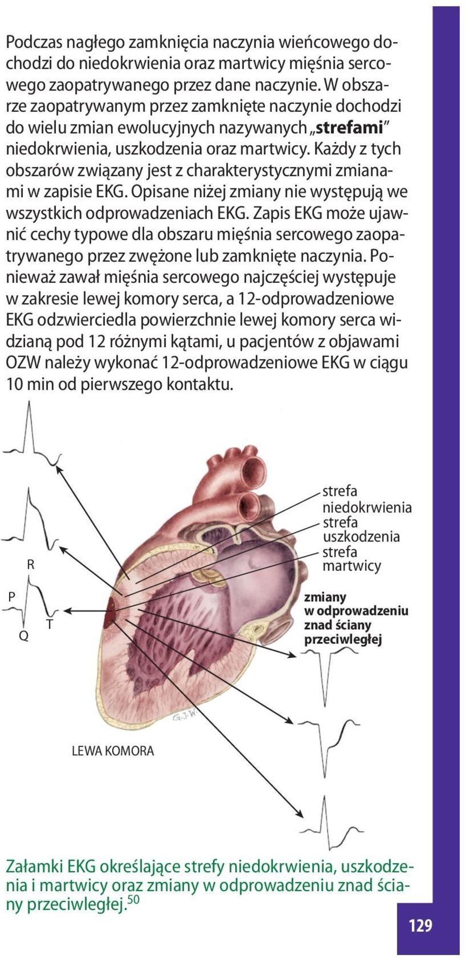 Każdy z tych obszarów związany jest z charakterystycznymi zmianami w zapisie EKG. Opisane niżej zmiany nie występują we wszystkich odprowadzeniach EKG.