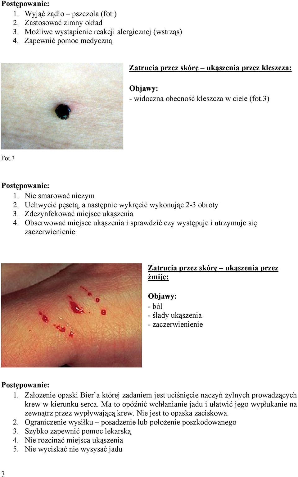 Uchwycić pęsetą, a następnie wykręcić wykonując 2-3 obroty 3. Zdezynfekować miejsce ukąszenia 4.