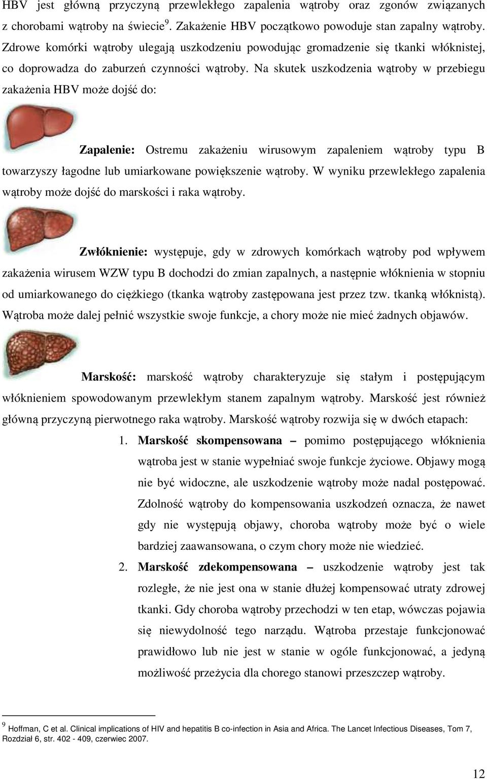 Na skutek uszkodzenia wątroby w przebiegu zakażenia HBV może dojść do: Zapalenie: Ostremu zakażeniu wirusowym zapaleniem wątroby typu B towarzyszy łagodne lub umiarkowane powiększenie wątroby.