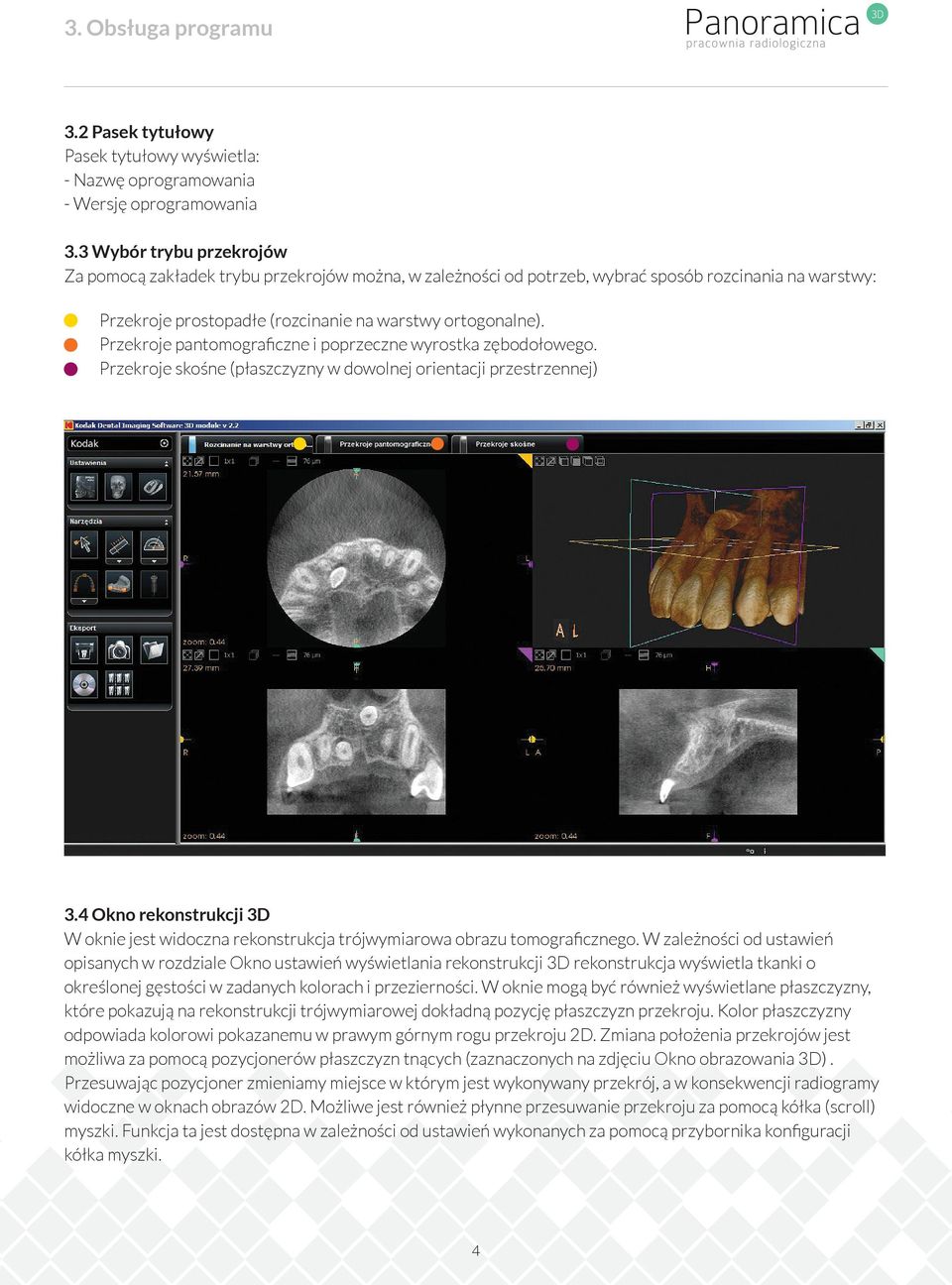 Przekroje pantomograﬁczne i poprzeczne wyrostka zębodołowego. Przekroje skośne (płaszczyzny w dowolnej orientacji przestrzennej) 3.