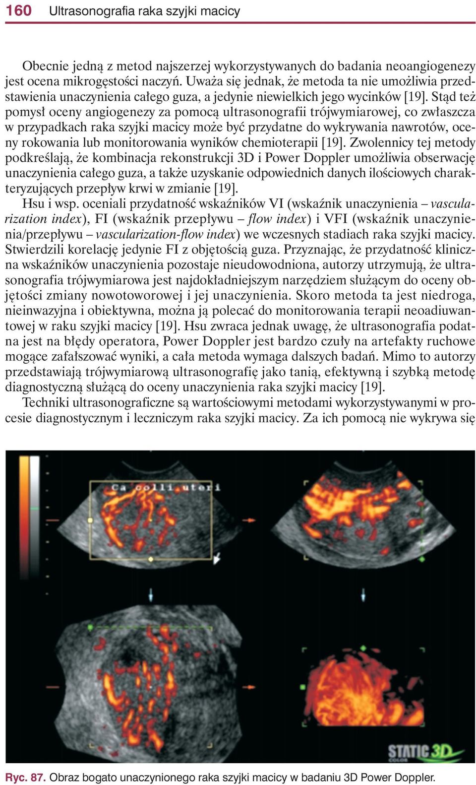 Stàd te pomys oceny angiogenezy za pomocà ultrasonografii trójwymiarowej, co zw aszcza w przypadkach raka szyjki macicy mo e byç przydatne do wykrywania nawrotów, oceny rokowania lub monitorowania