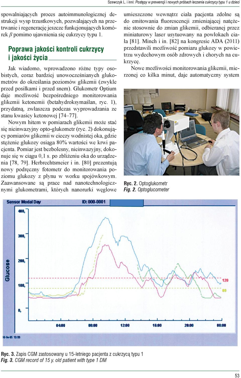 przed snem). Glukometr Optium daje możliwość bezpośredniego monitorowania glikemii ketonemii (betahydroksymaślan, ryc.
