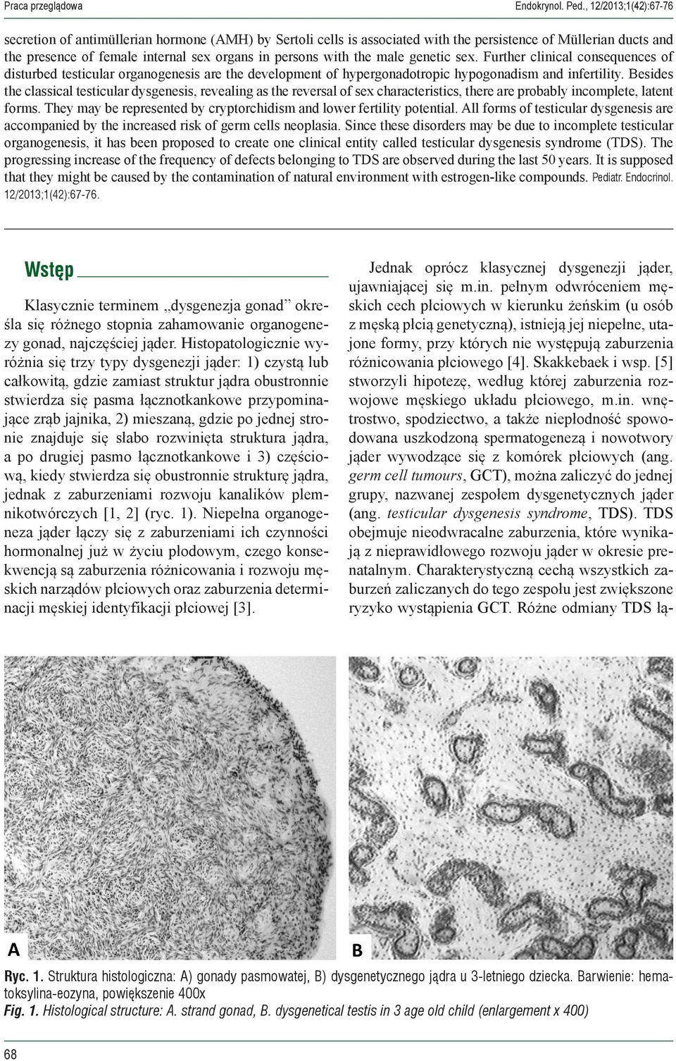 the male genetic sex. Further clinical consequences of disturbed testicular organogenesis are the development of hypergonadotropic hypogonadism and infertility.