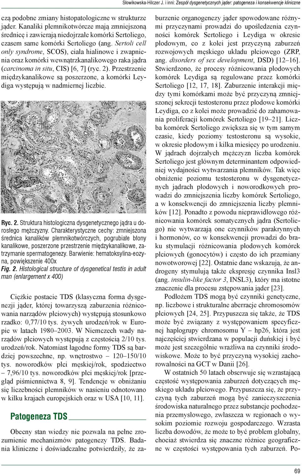 Sertoli cell only syndrome, SCOS), ciała hialinowe i zwapnienia oraz komórki wewnątrzkanalikowego raka jądra (carcinoma in situ, CIS) [6, 7] (ryc. 2).