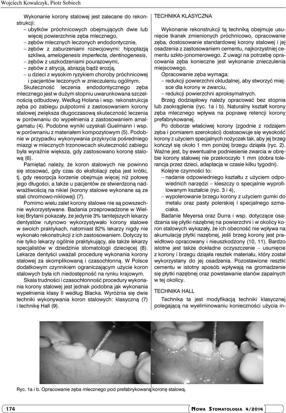 wysokim ryzykiem choroby próchnicowej i pacjentów leczonych w znieczuleniu ogólnym. Skuteczność leczenia endodontycznego zęba mlecznego jest w dużym stopniu uwarunkowana szczelnością odbudowy.